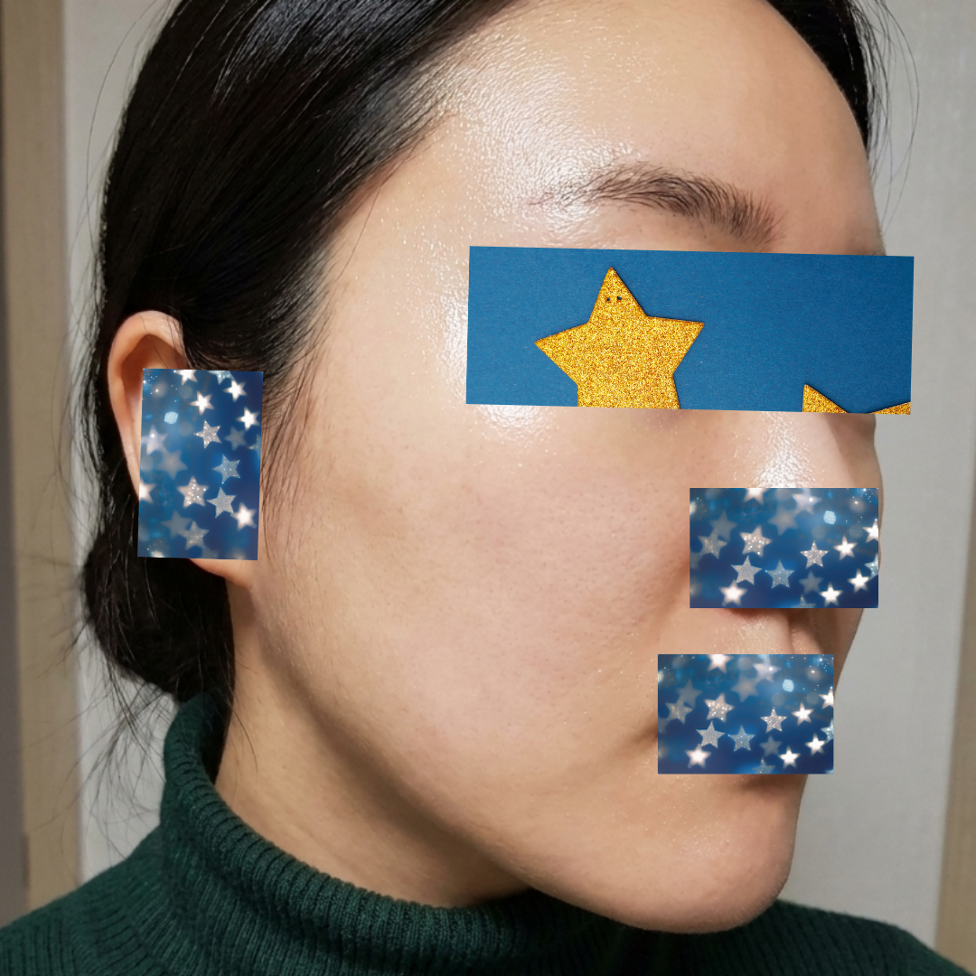 수술후기이미지