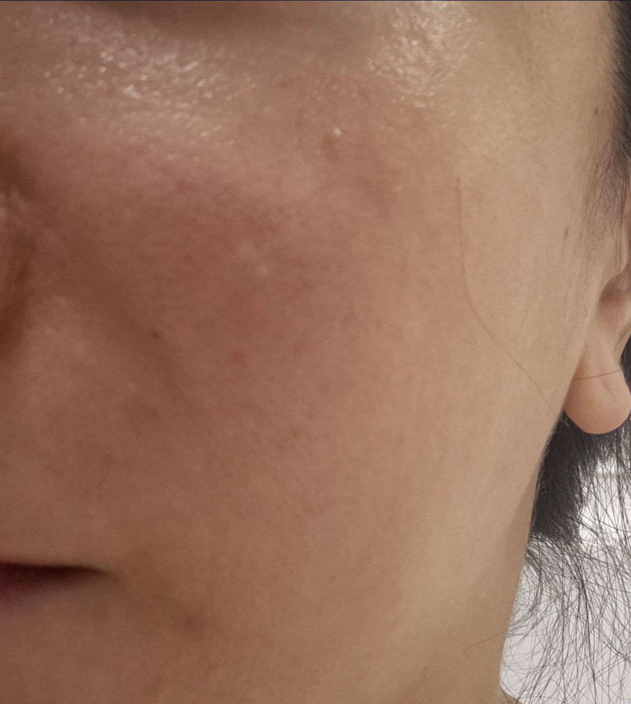 수술후기이미지