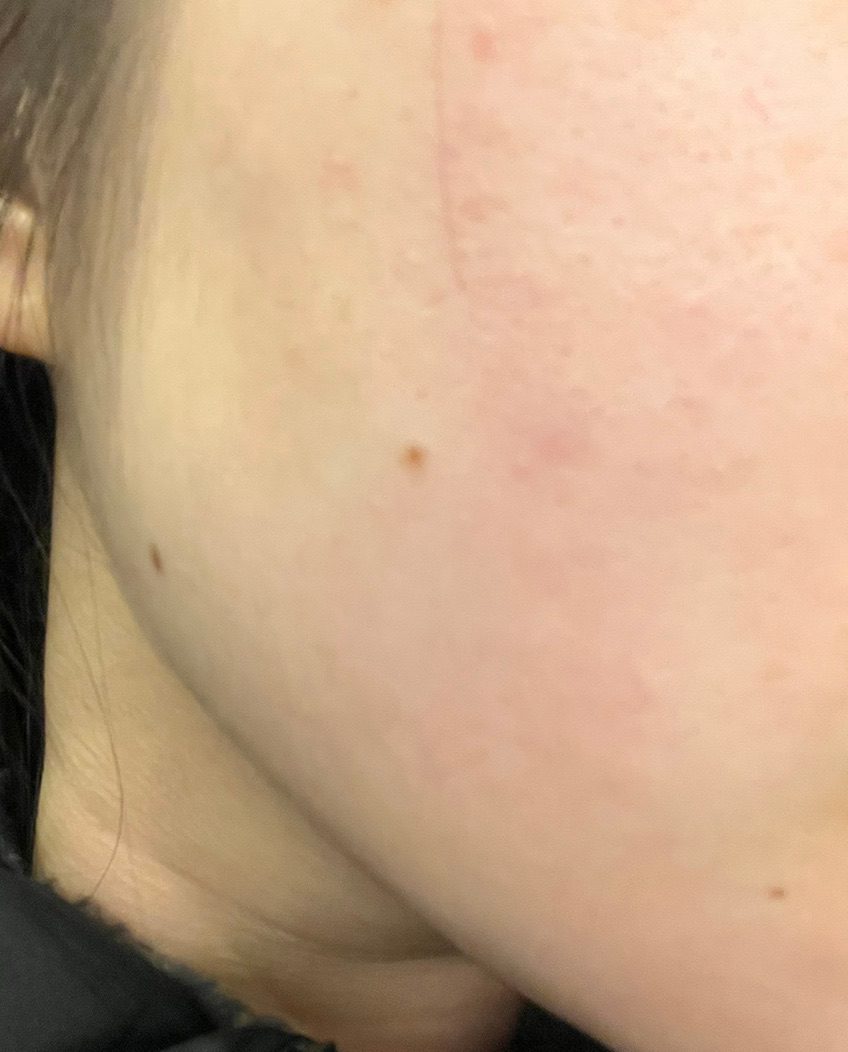 수술후기이미지