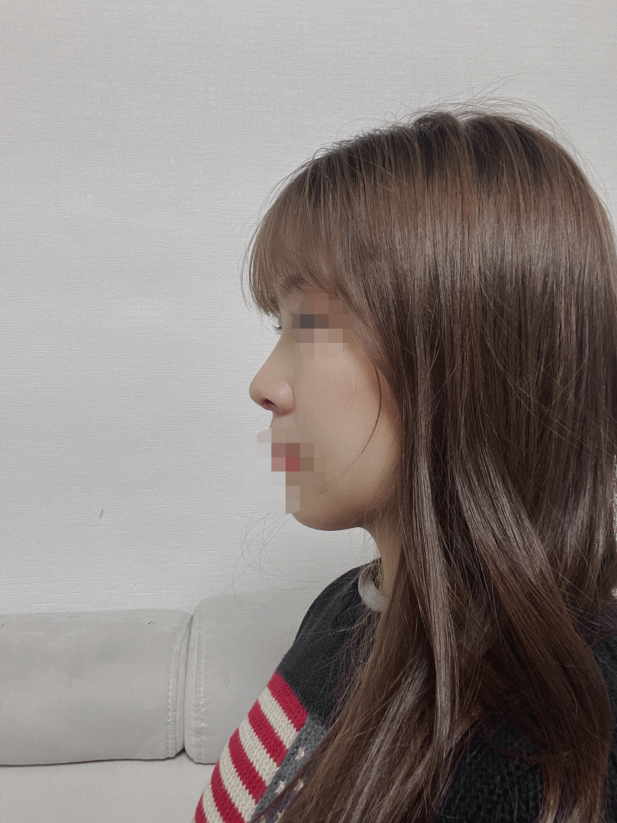 수술후기이미지