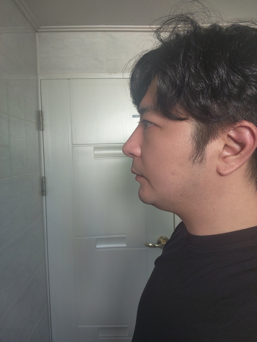 수술후기이미지