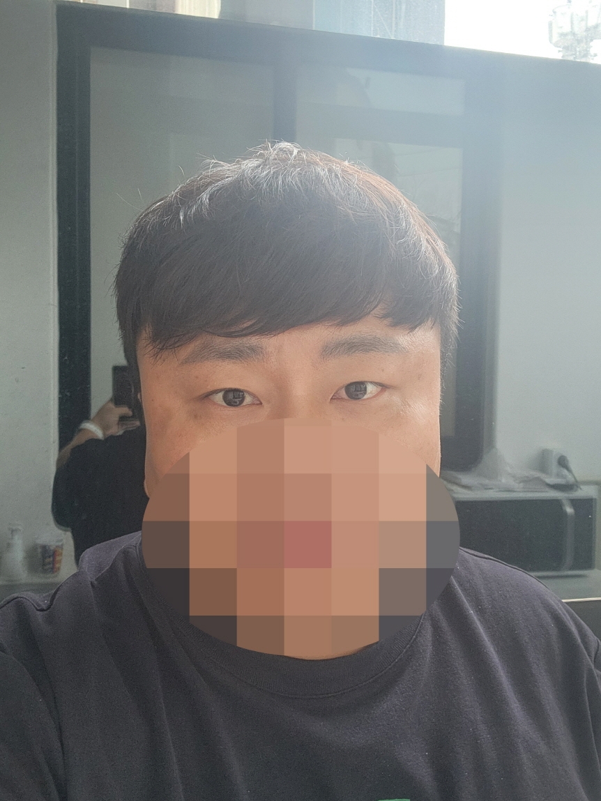 수술후기이미지