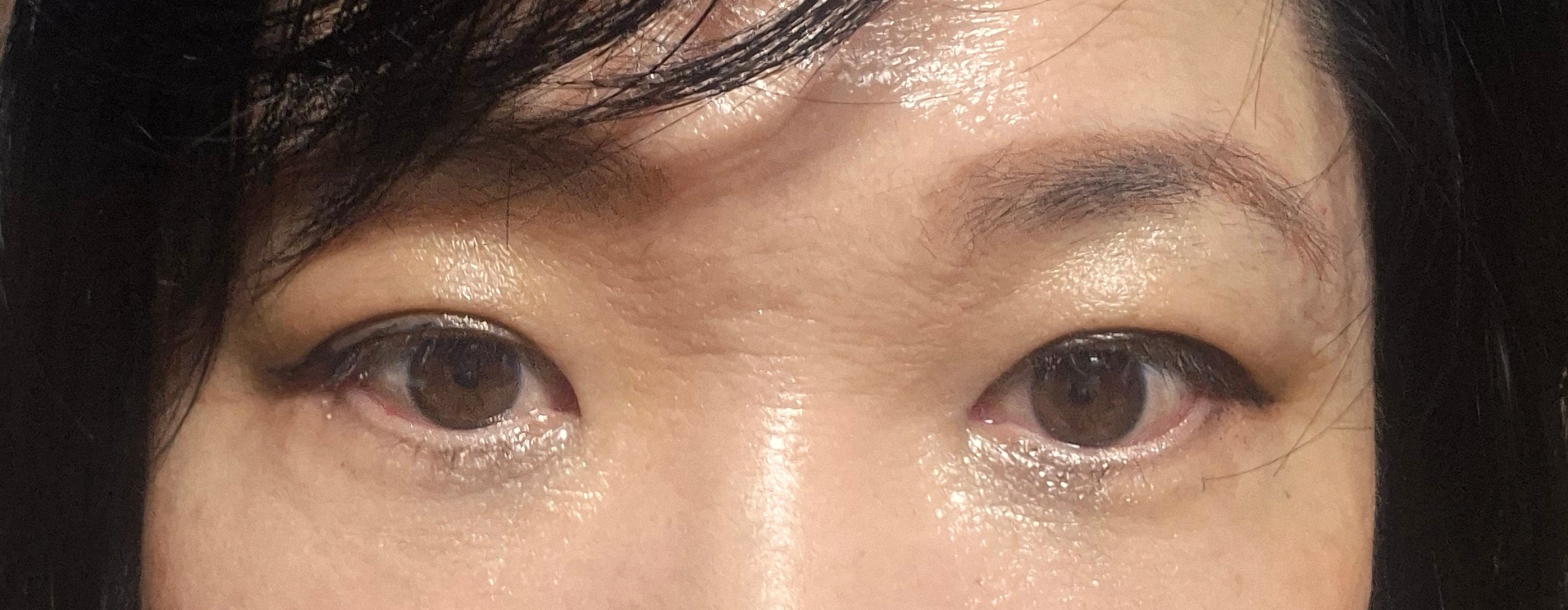 수술후기이미지