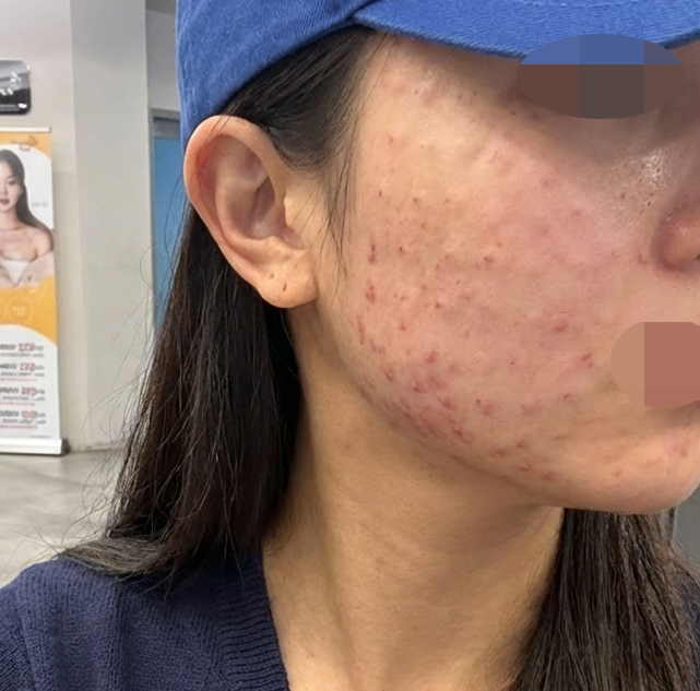 수술후기이미지