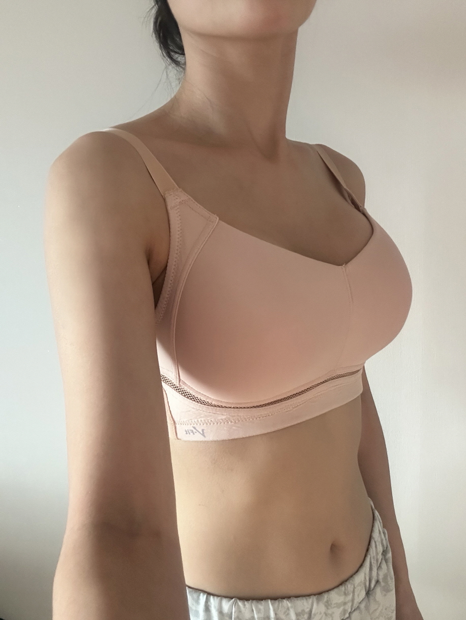 수술후기이미지