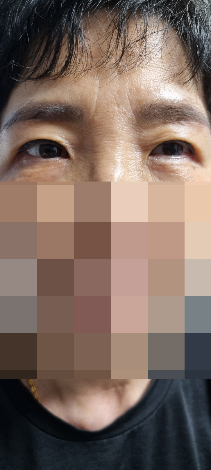 수술후기이미지