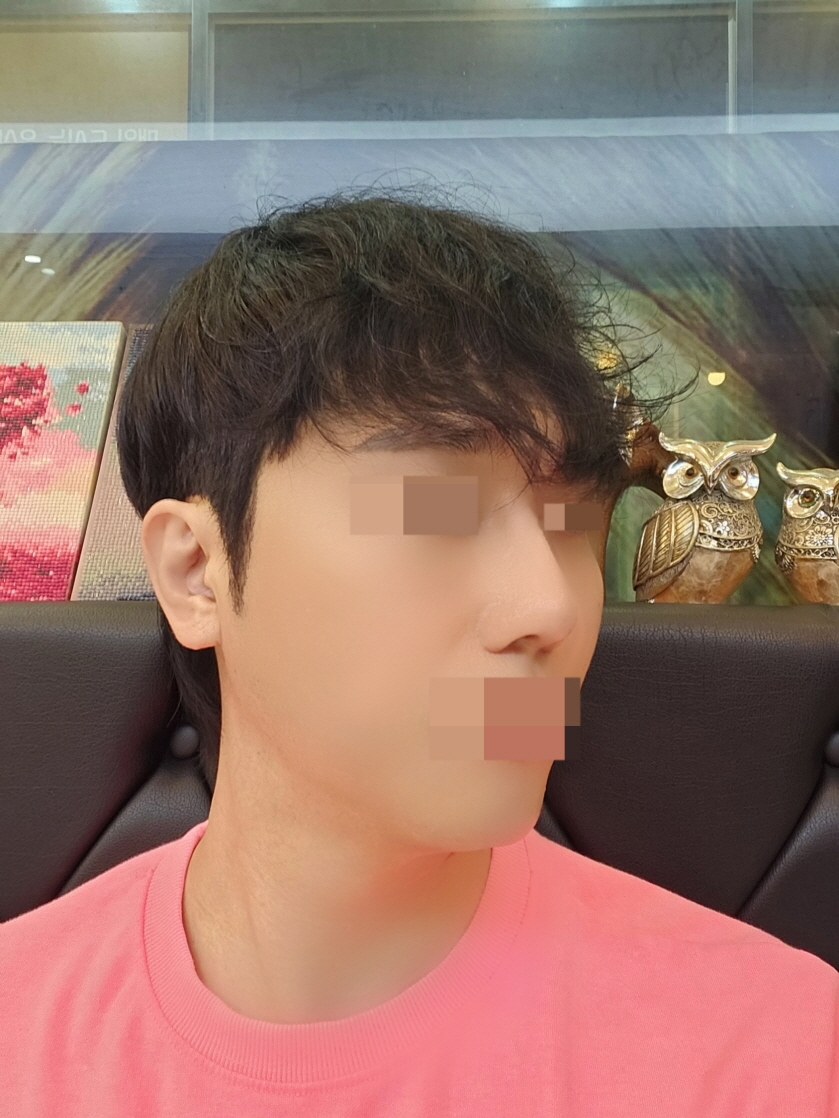 수술후기이미지