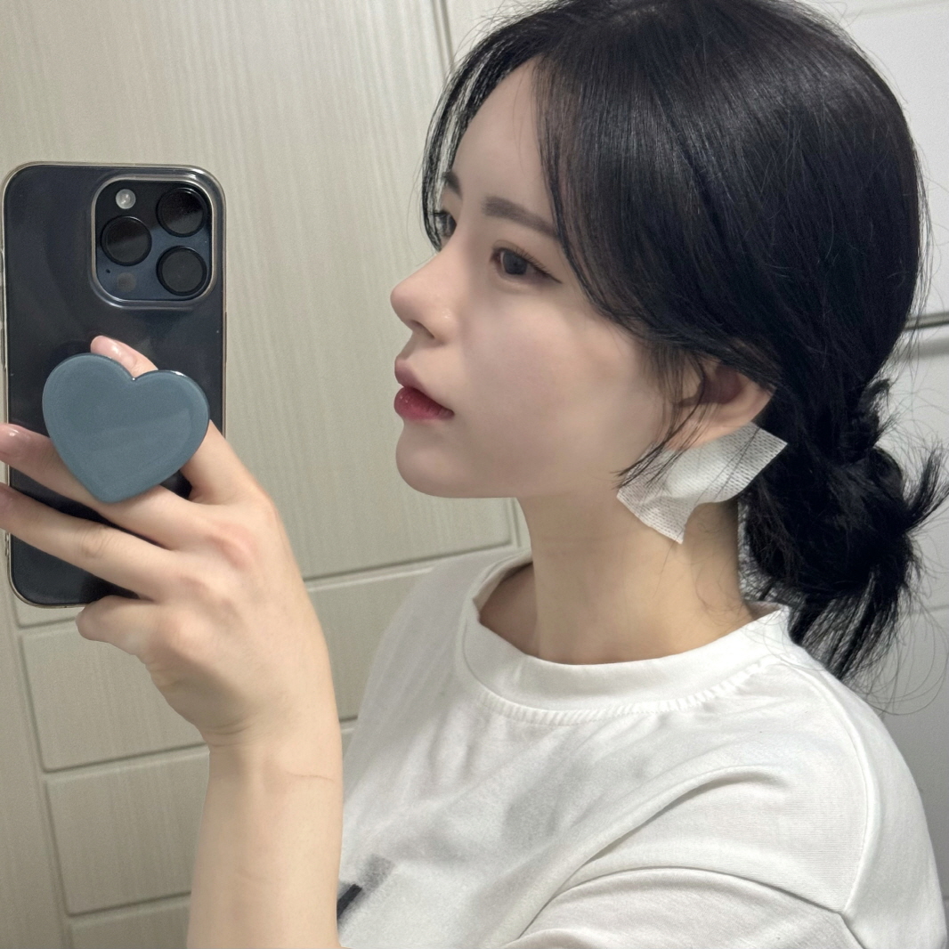 수술후기이미지