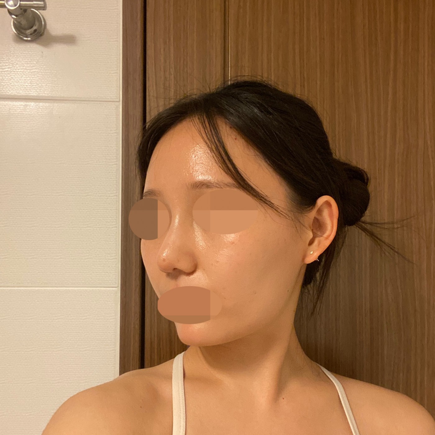 수술후기이미지