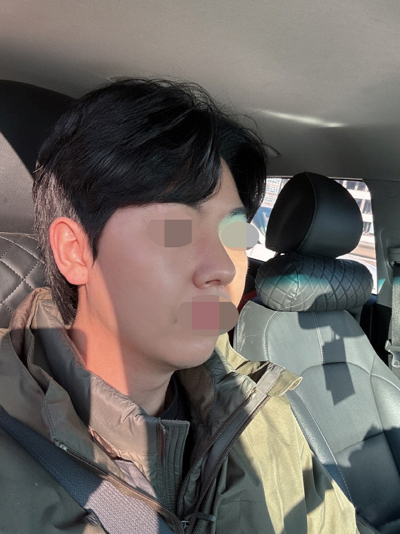 수술후기이미지