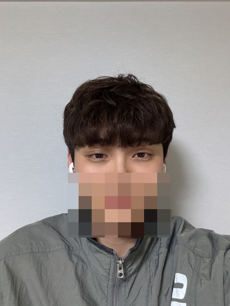 수술후기이미지