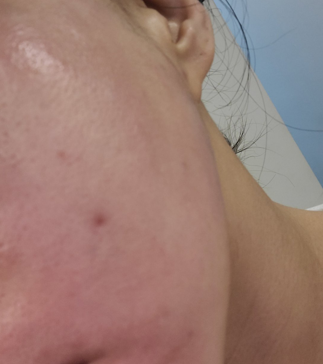 수술후기이미지