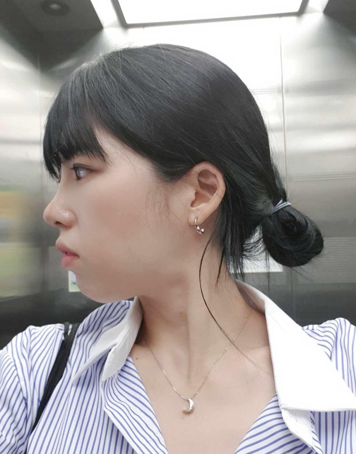 수술후기이미지