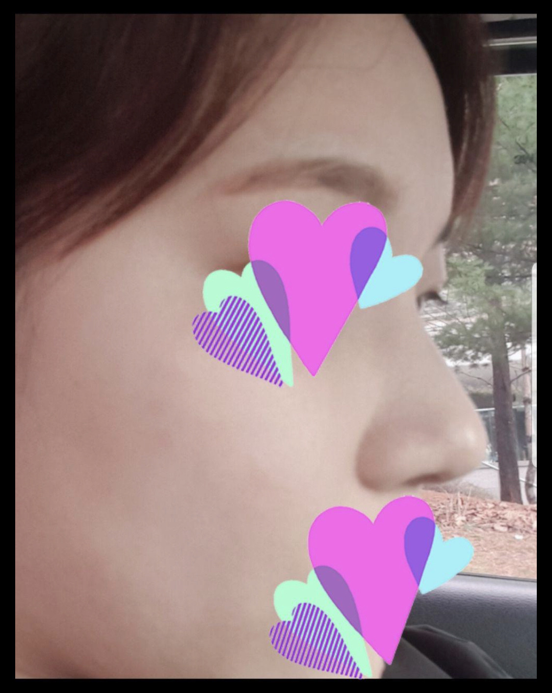 수술후기이미지