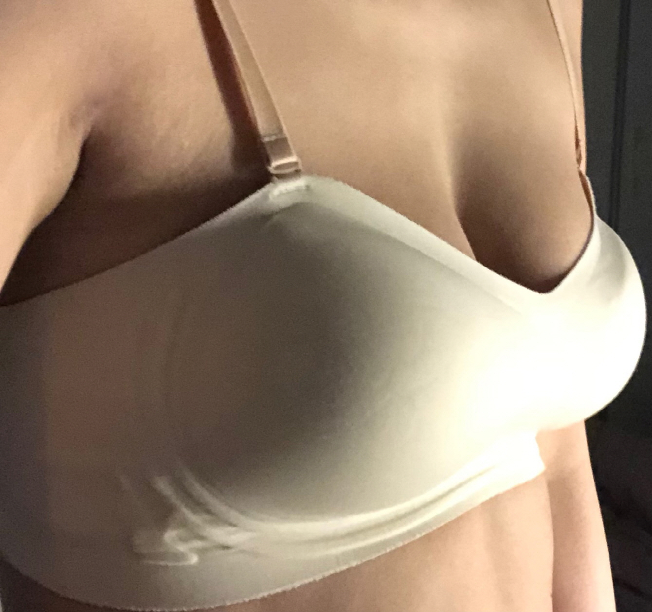 수술후기이미지