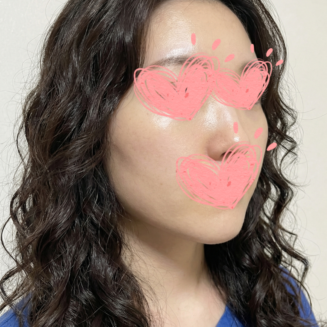 수술후기이미지