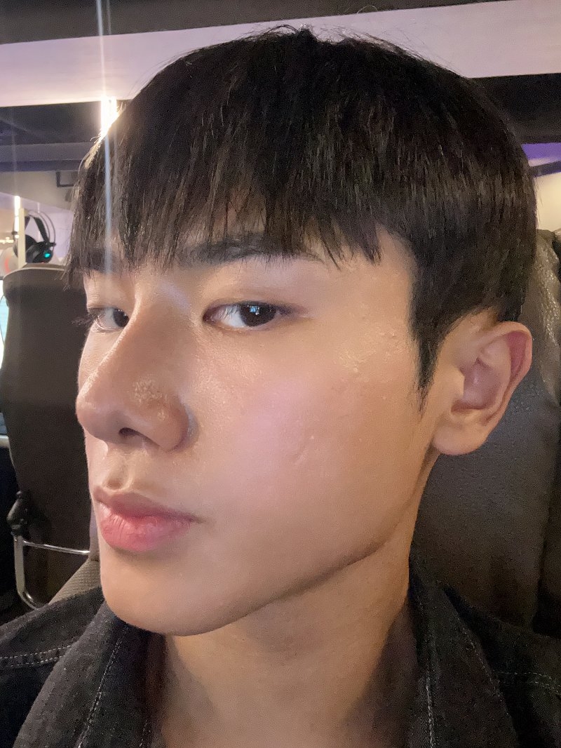 수술후기이미지