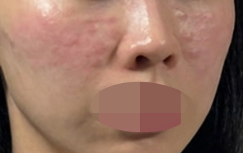 수술후기이미지