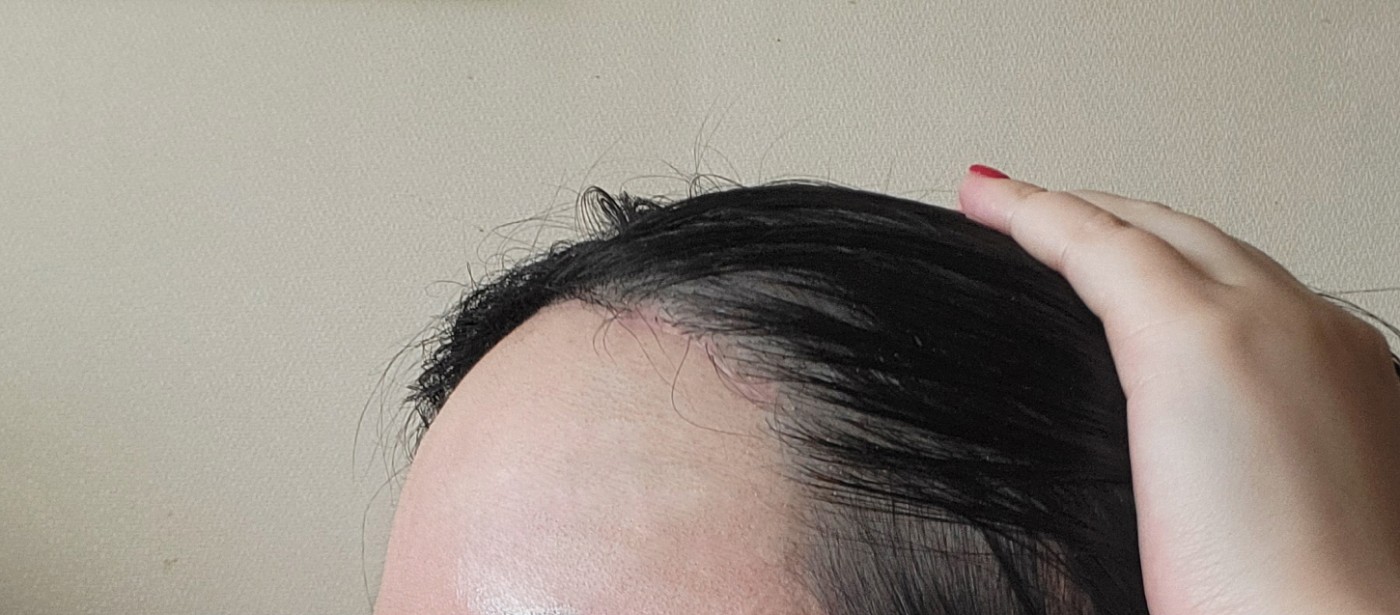 수술후기이미지