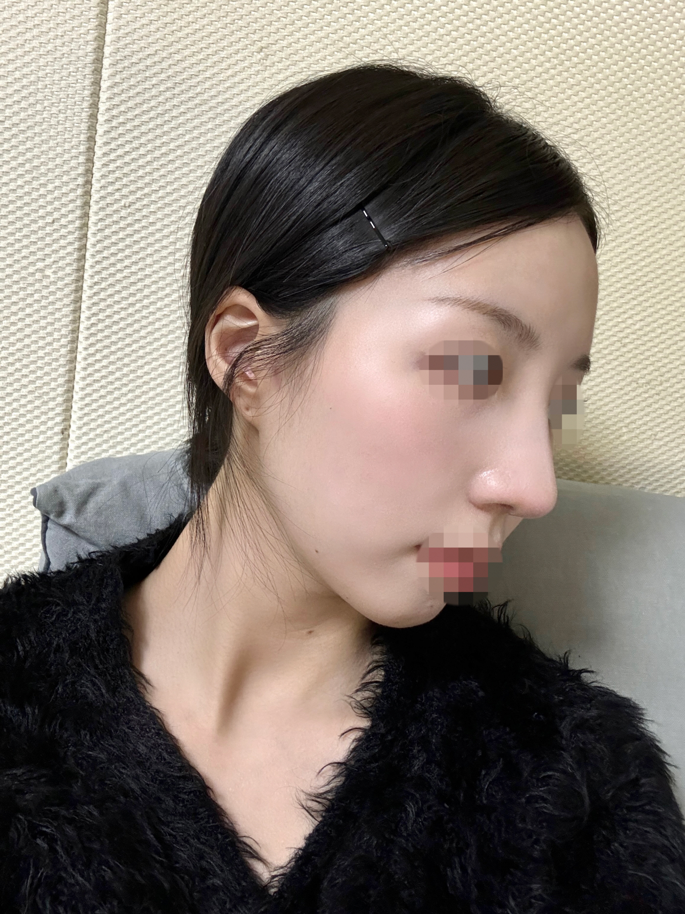 수술후기이미지