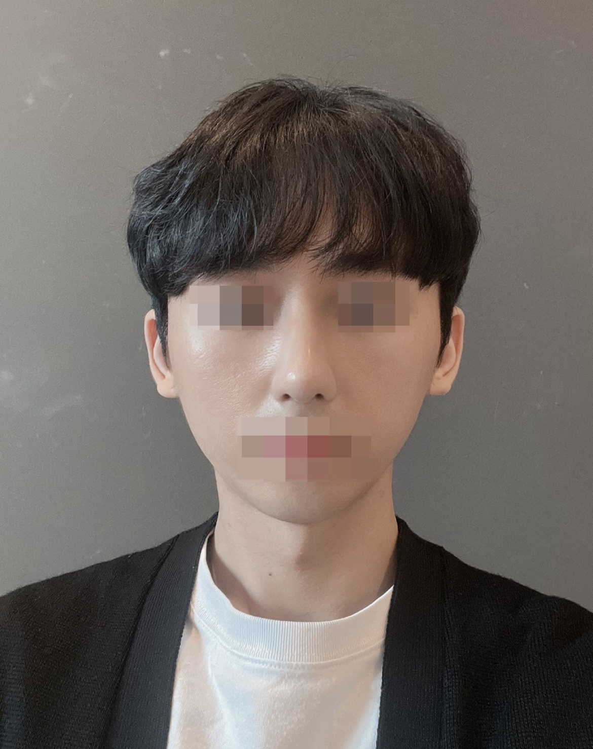 수술후기이미지