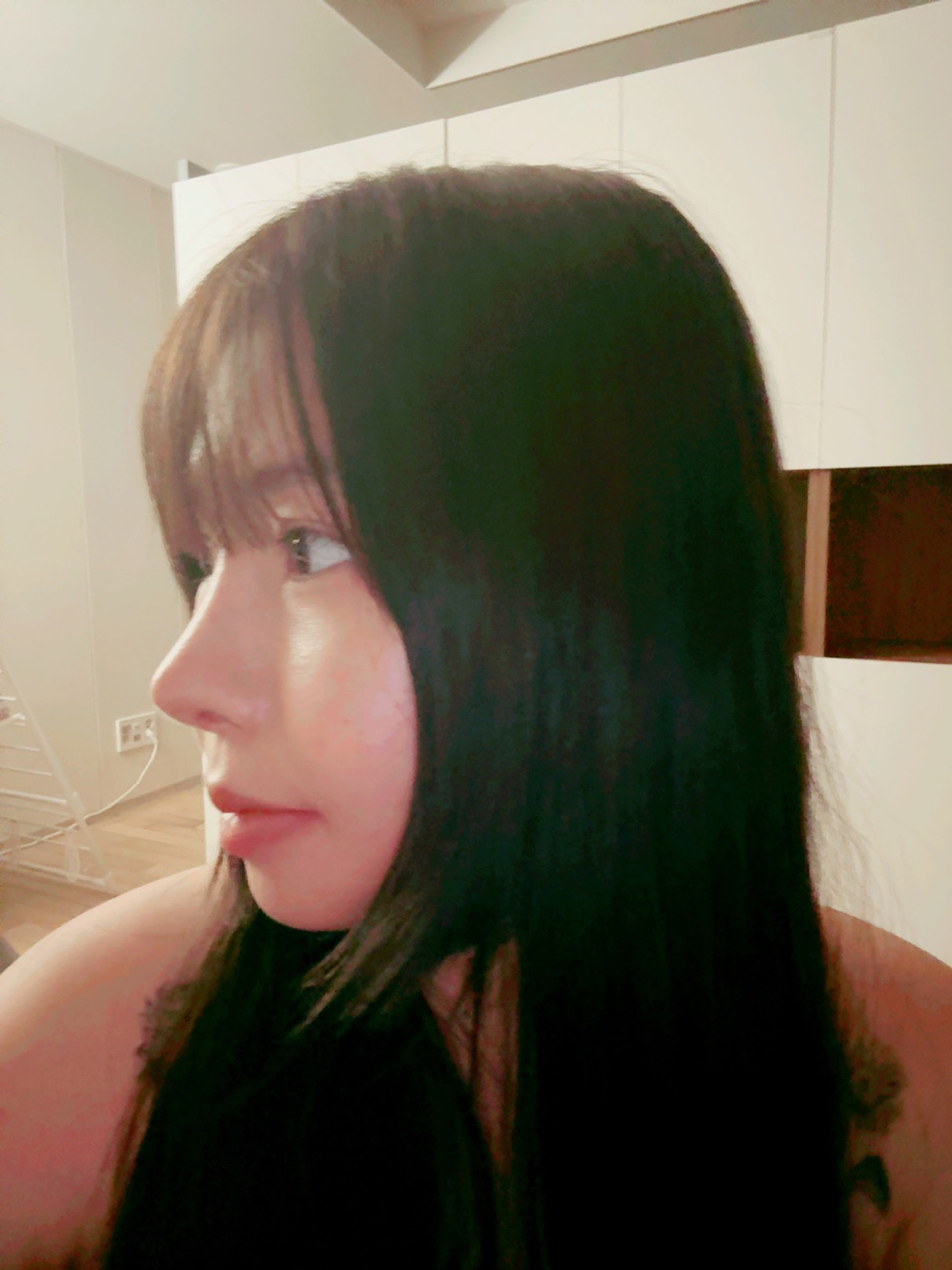 수술후기이미지