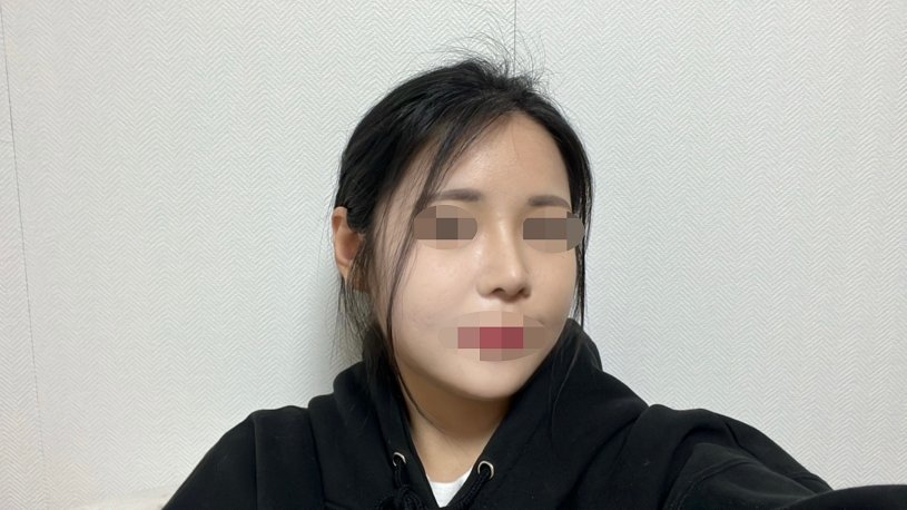 수술후기이미지