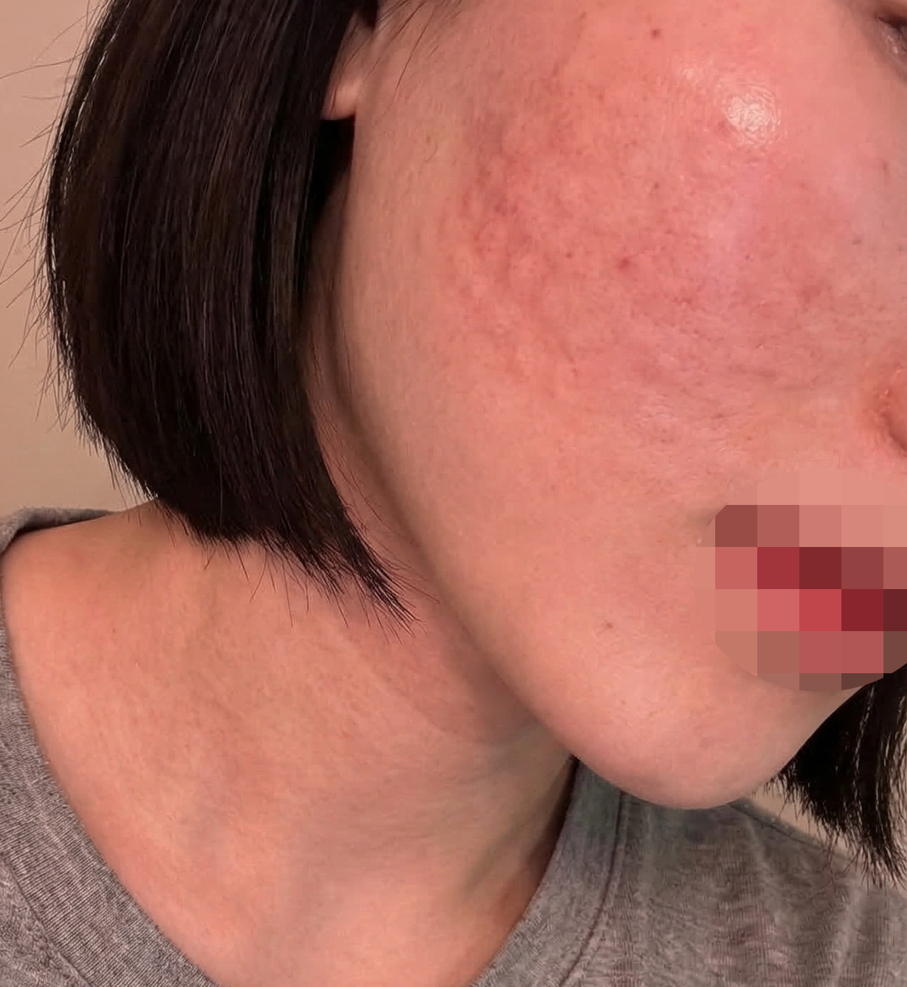 수술후기이미지