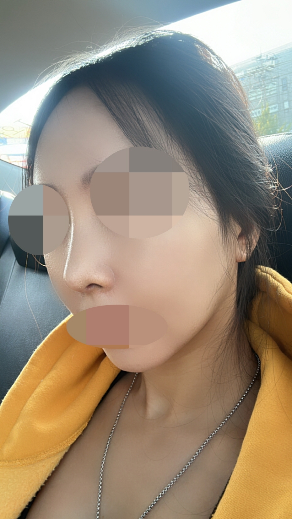 수술후기이미지