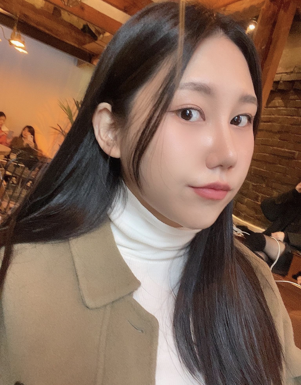 수술후기이미지