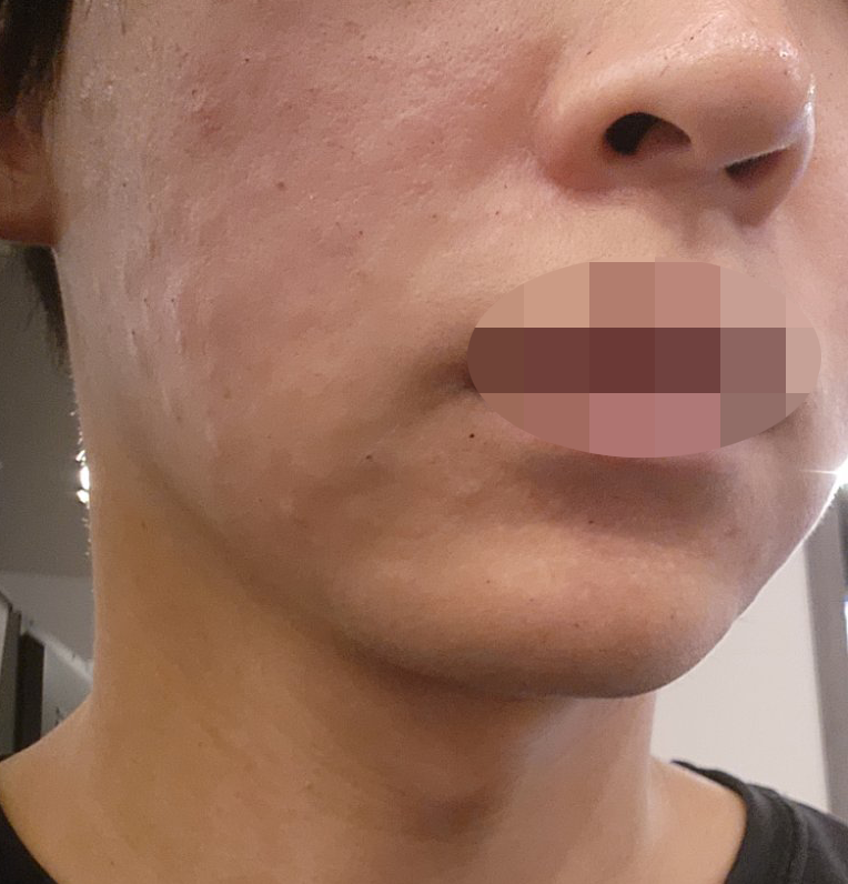 수술후기이미지