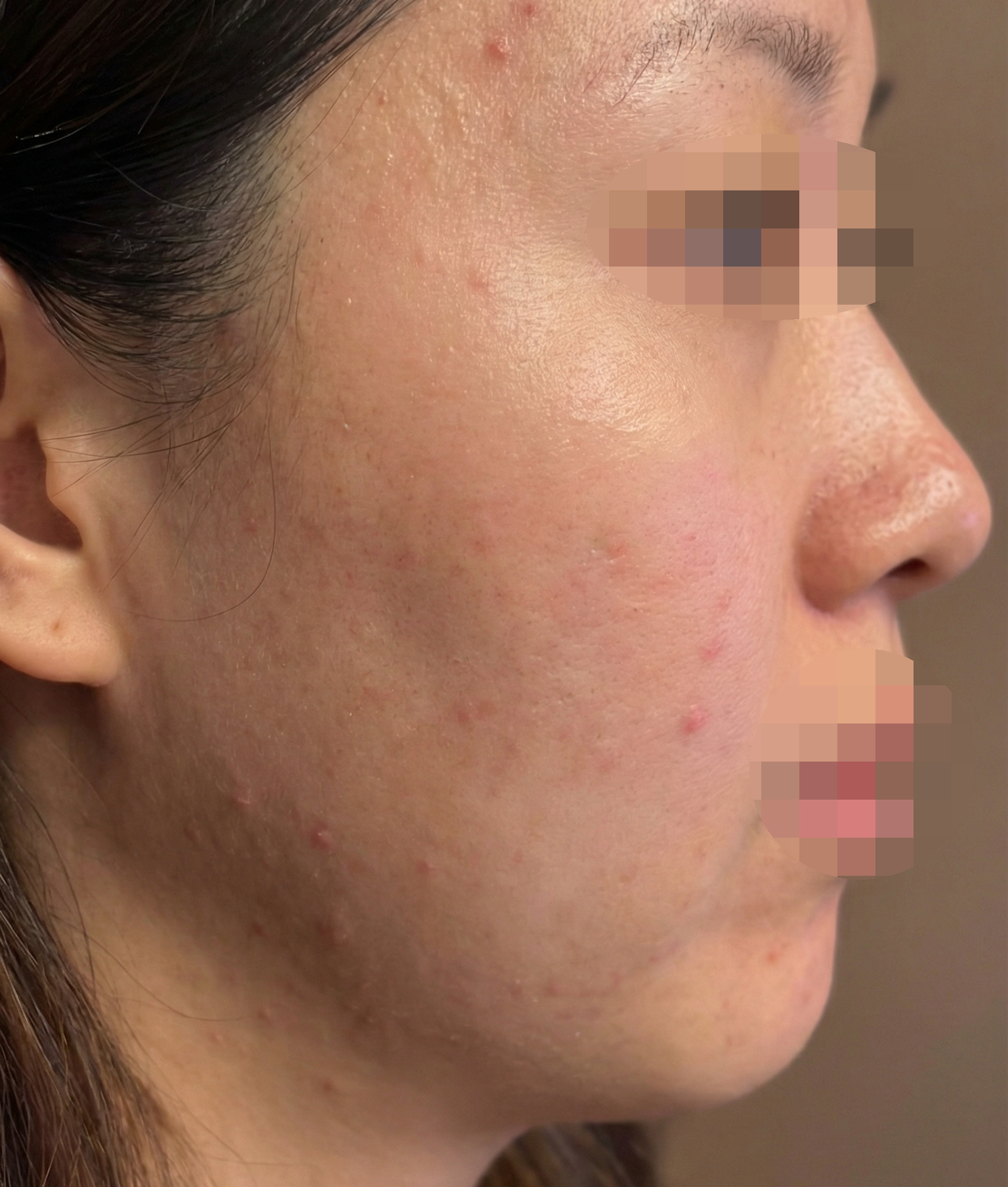 수술후기이미지