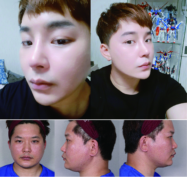 수술후기이미지