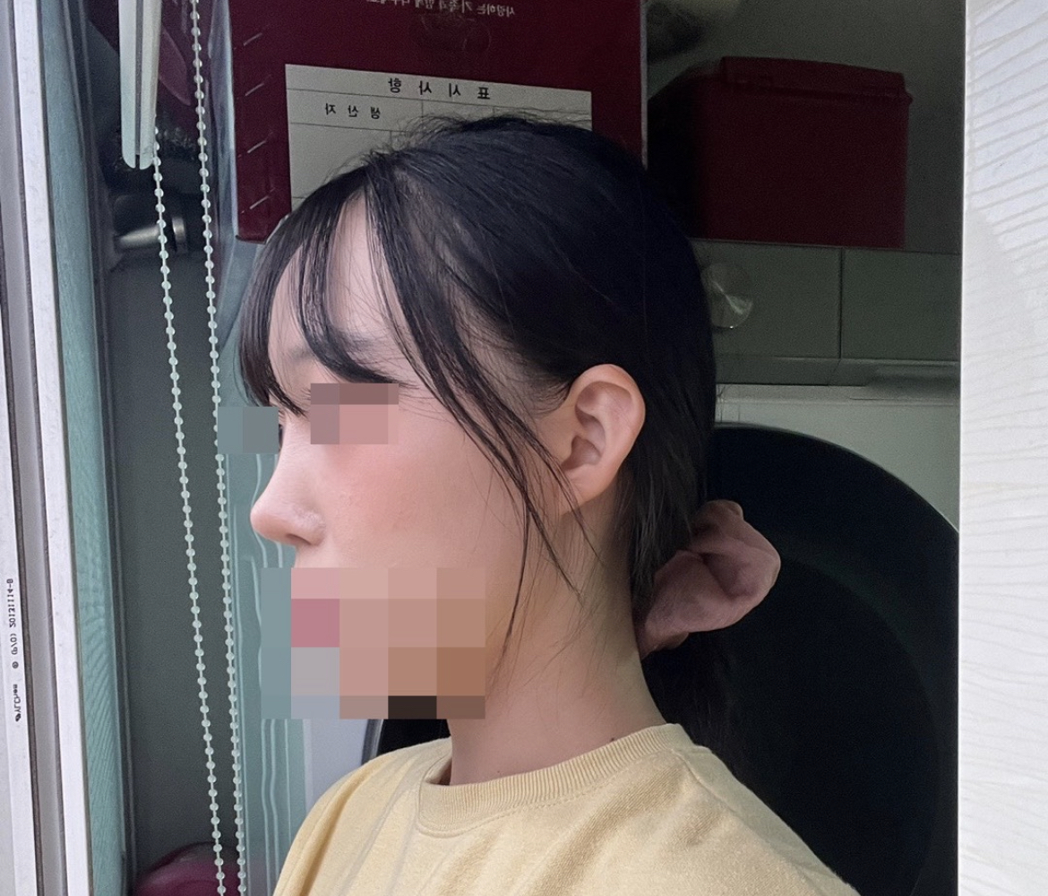 수술후기이미지