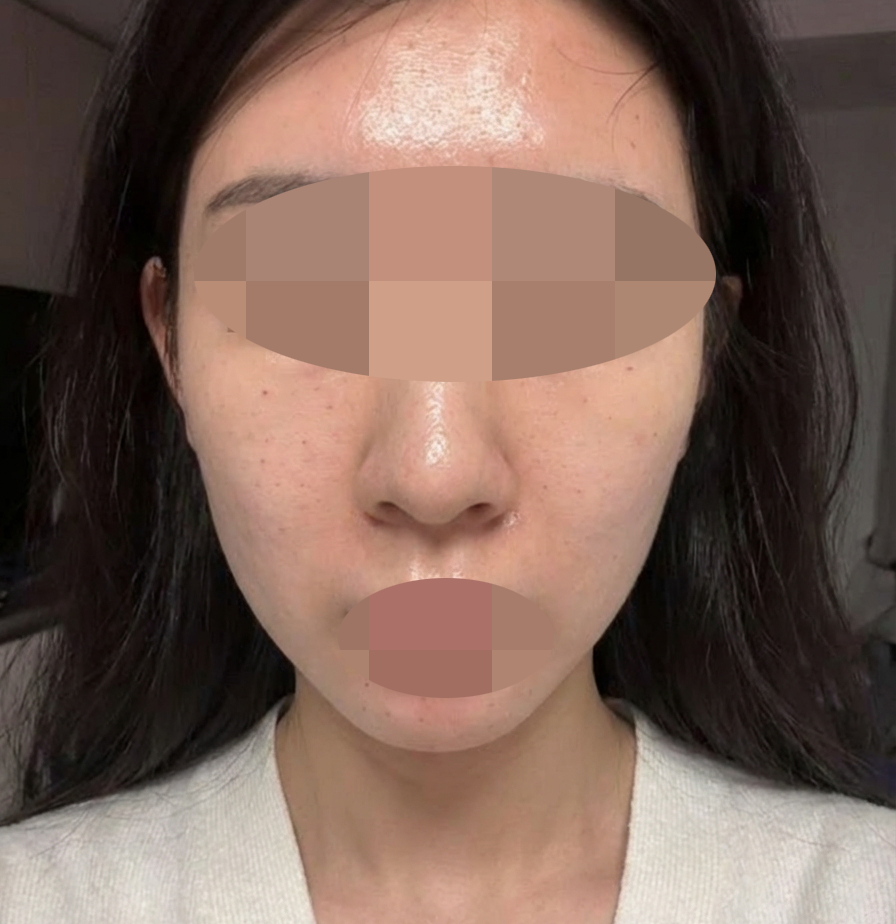 수술후기이미지