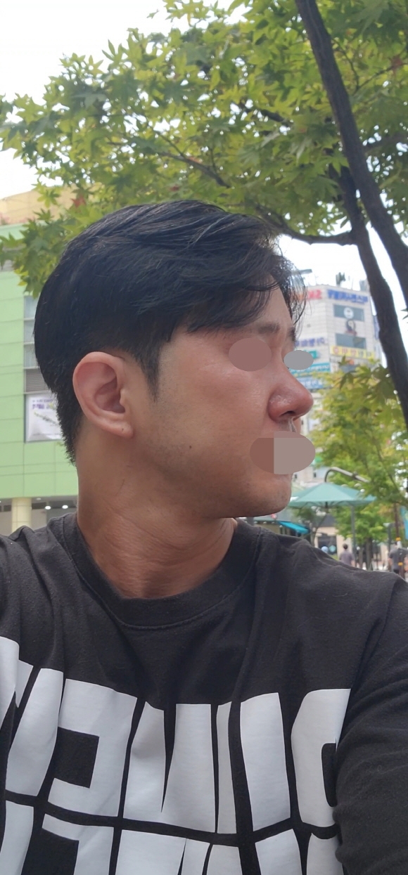 수술후기이미지