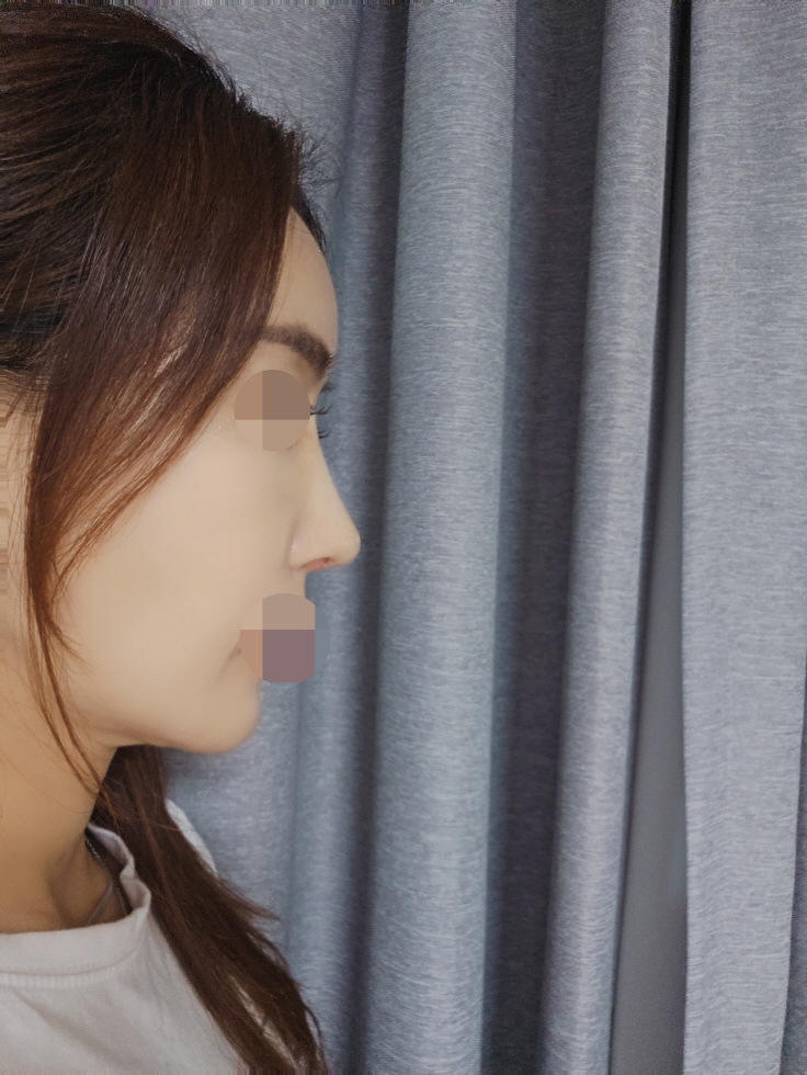 수술후기이미지