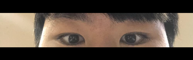 수술후기이미지