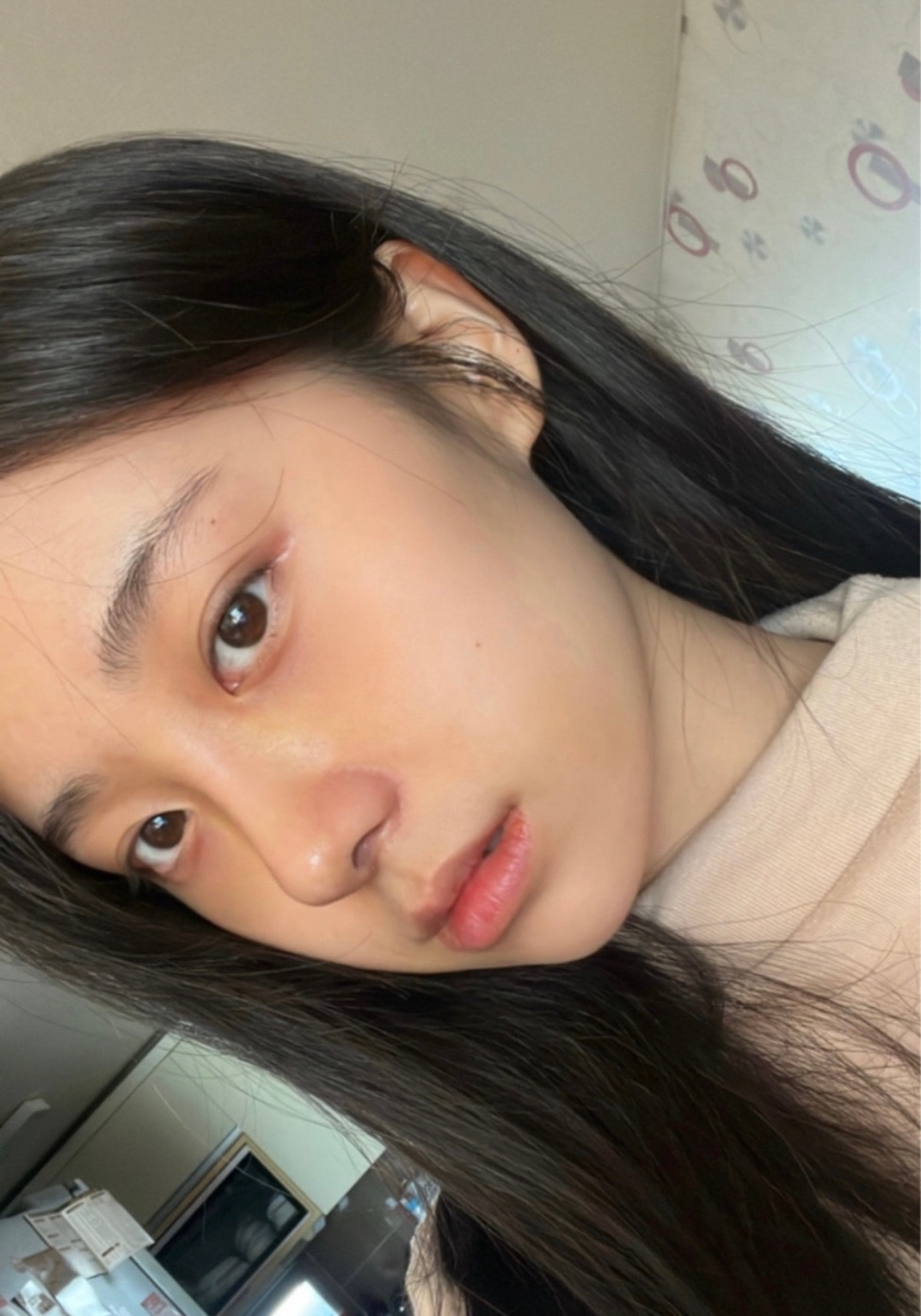 수술후기이미지