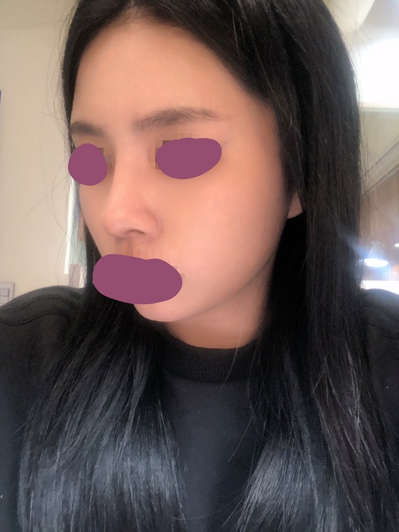 수술후기이미지