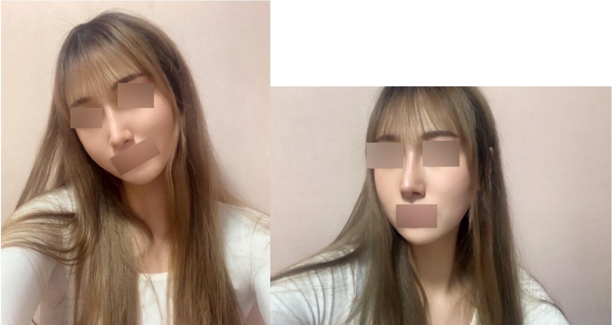 수술후기이미지