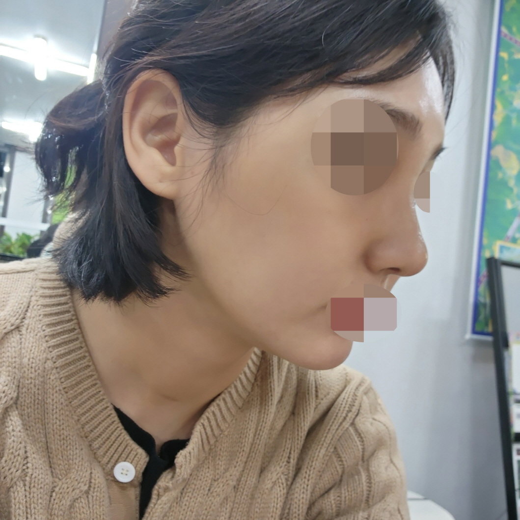 수술후기이미지