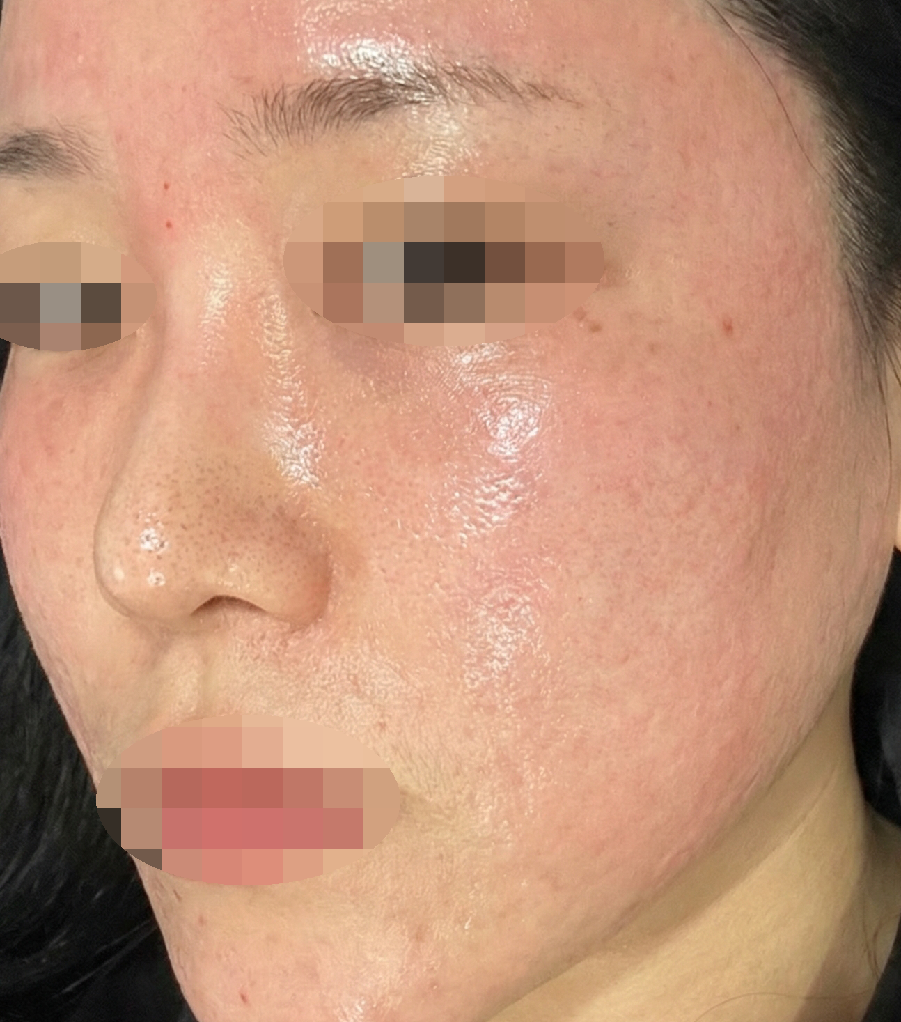 수술후기이미지