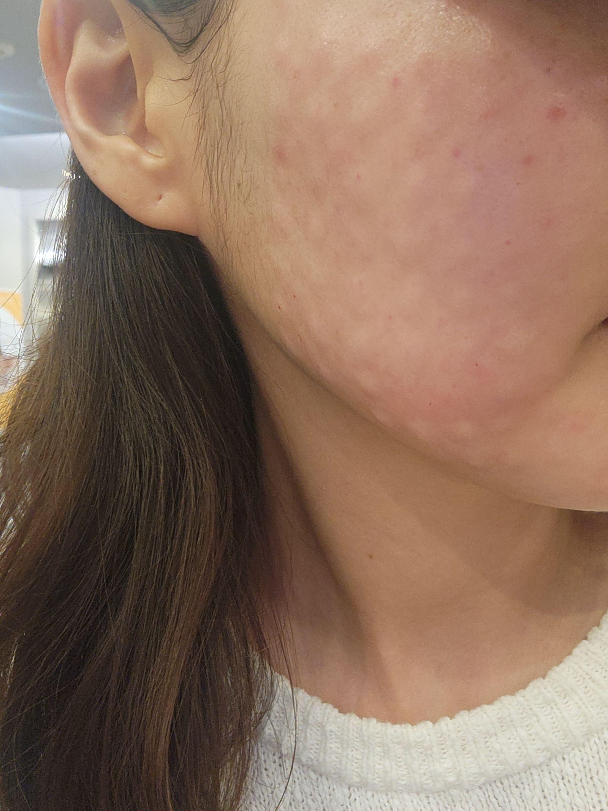 수술후기이미지