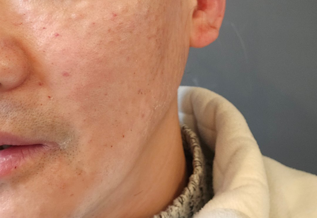 수술후기이미지