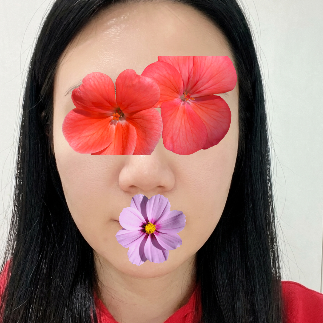 수술후기이미지