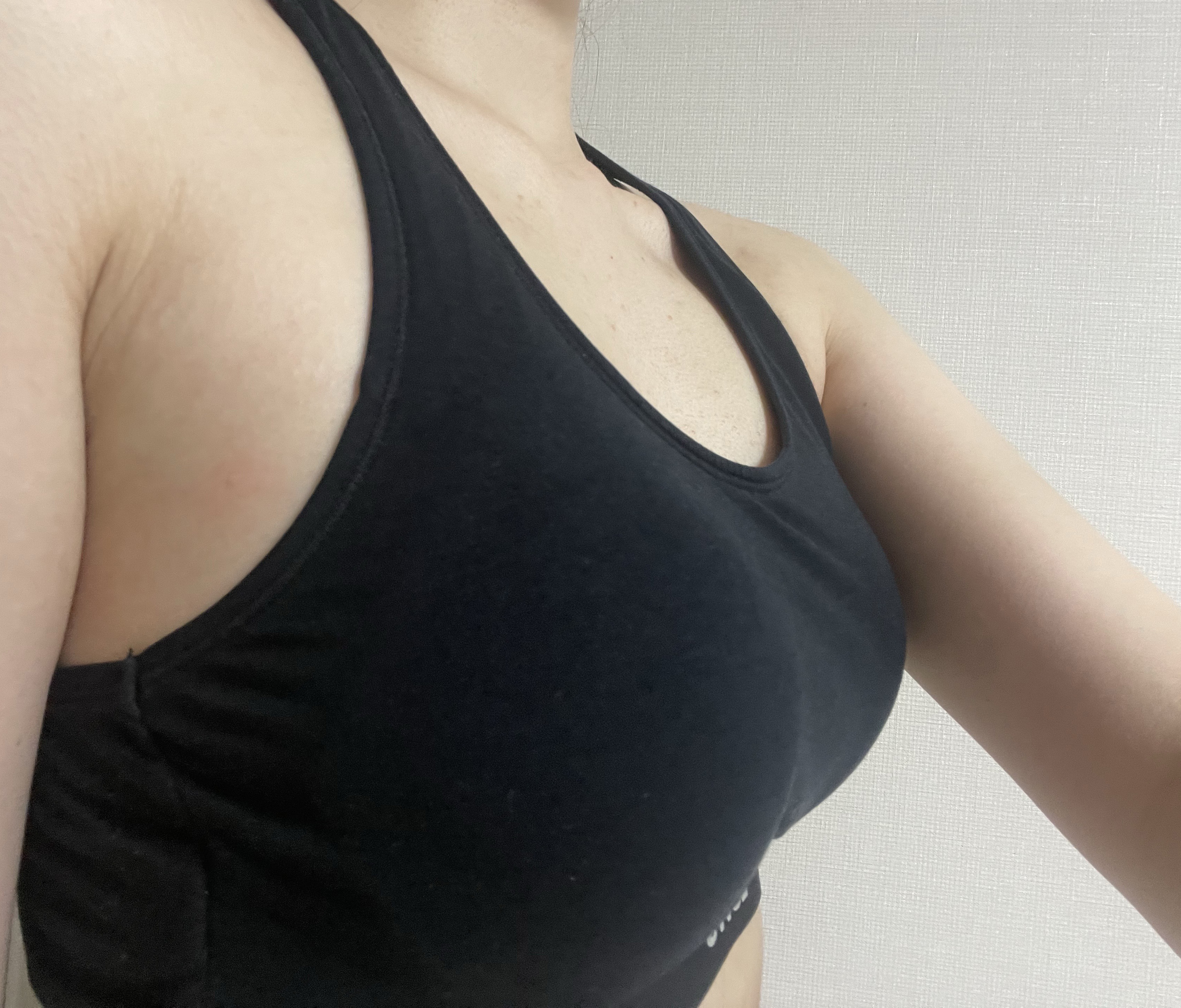 수술후기이미지