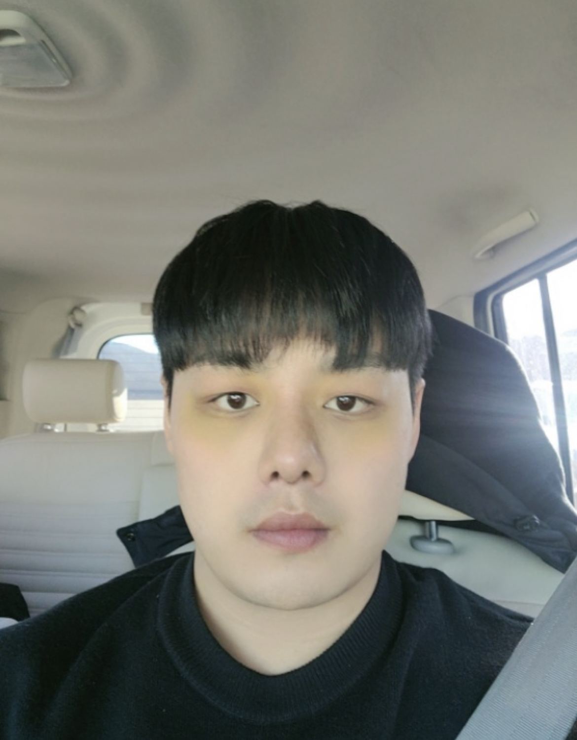 수술후기이미지