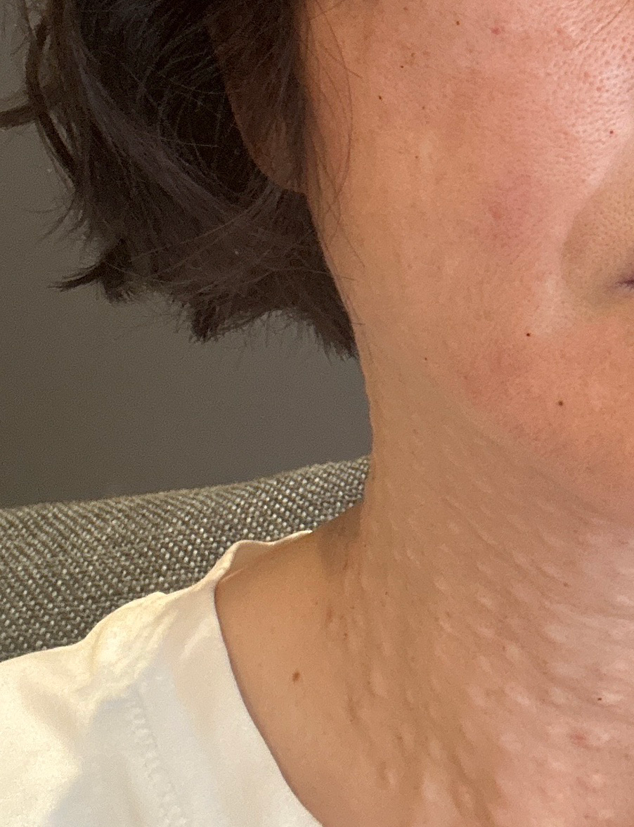 수술후기이미지