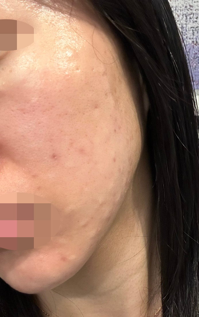 수술후기이미지